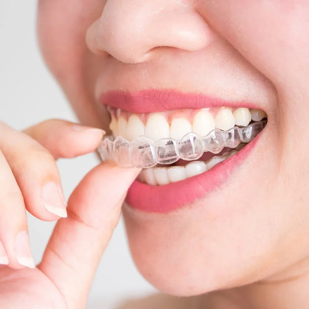 1-4Pc Anti Snoring Bruxism Sle - Teeth Whitening Mouth Guard review and price