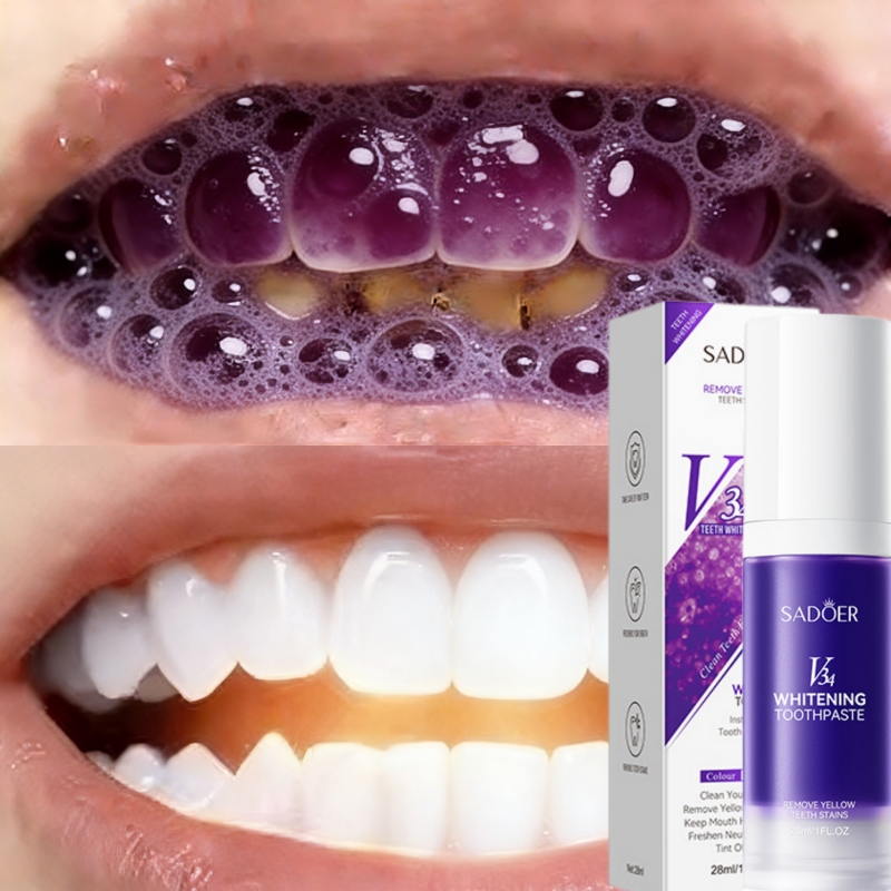 2026 Bestselling Whitening Too - Teeth Whitening Effective review and price