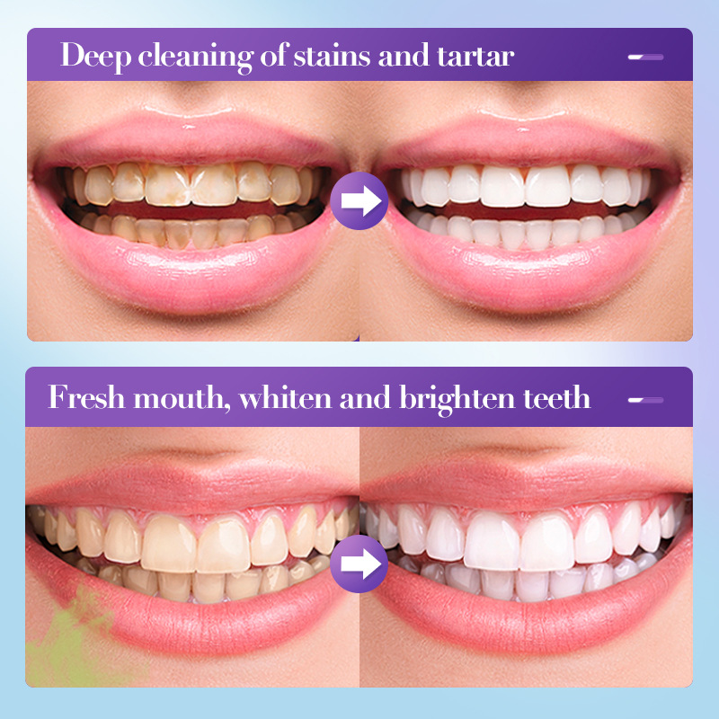 2026 Bestselling Whitening Too - Teeth Whitening Effective review and price