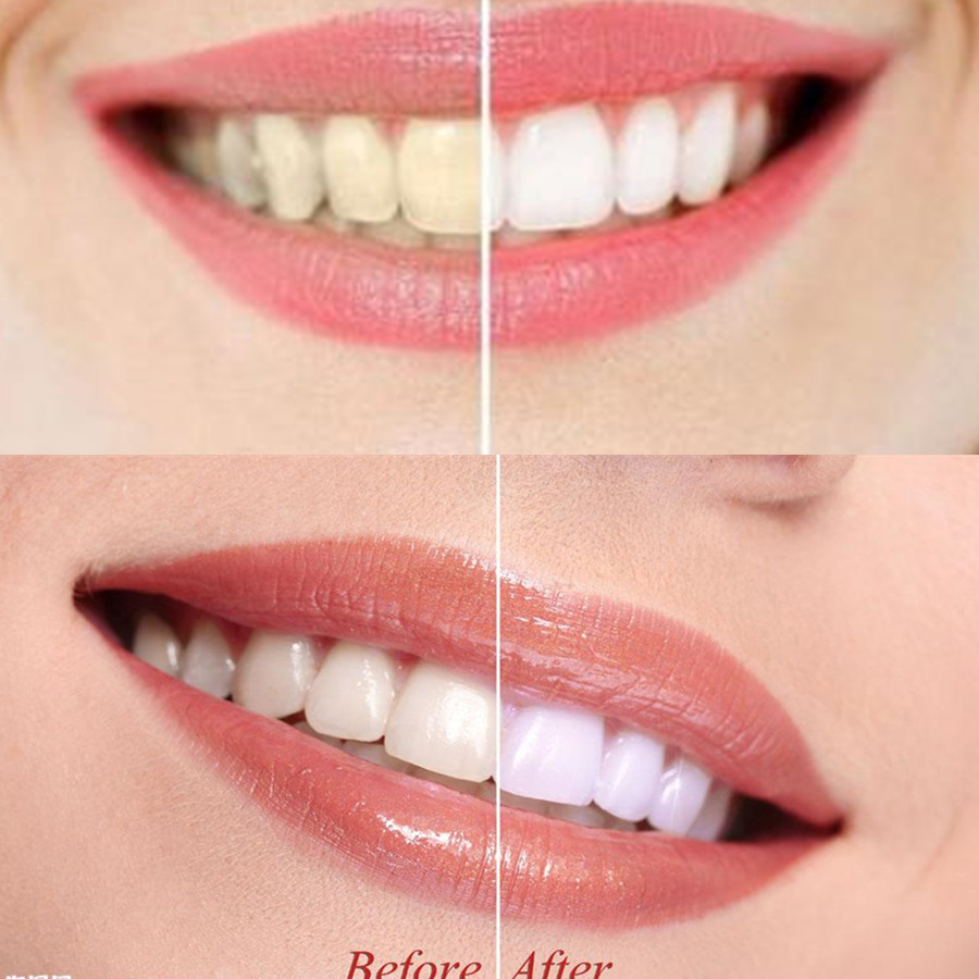 Bamboo Charcoal Teeth Tooth De - Teeth Whitening Results review and price