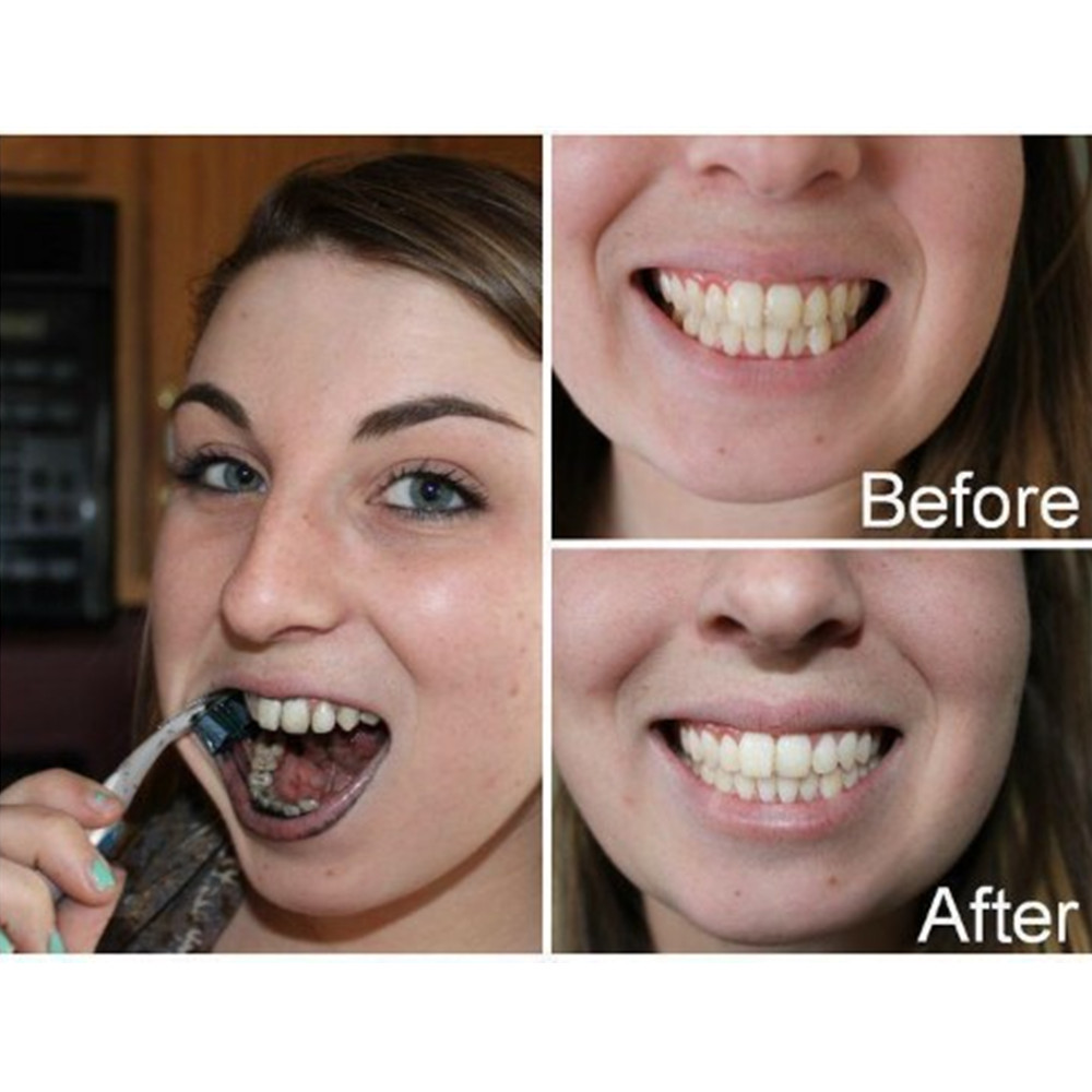 Bamboo Charcoal Teeth Tooth De - Teeth Whitening Results review and price