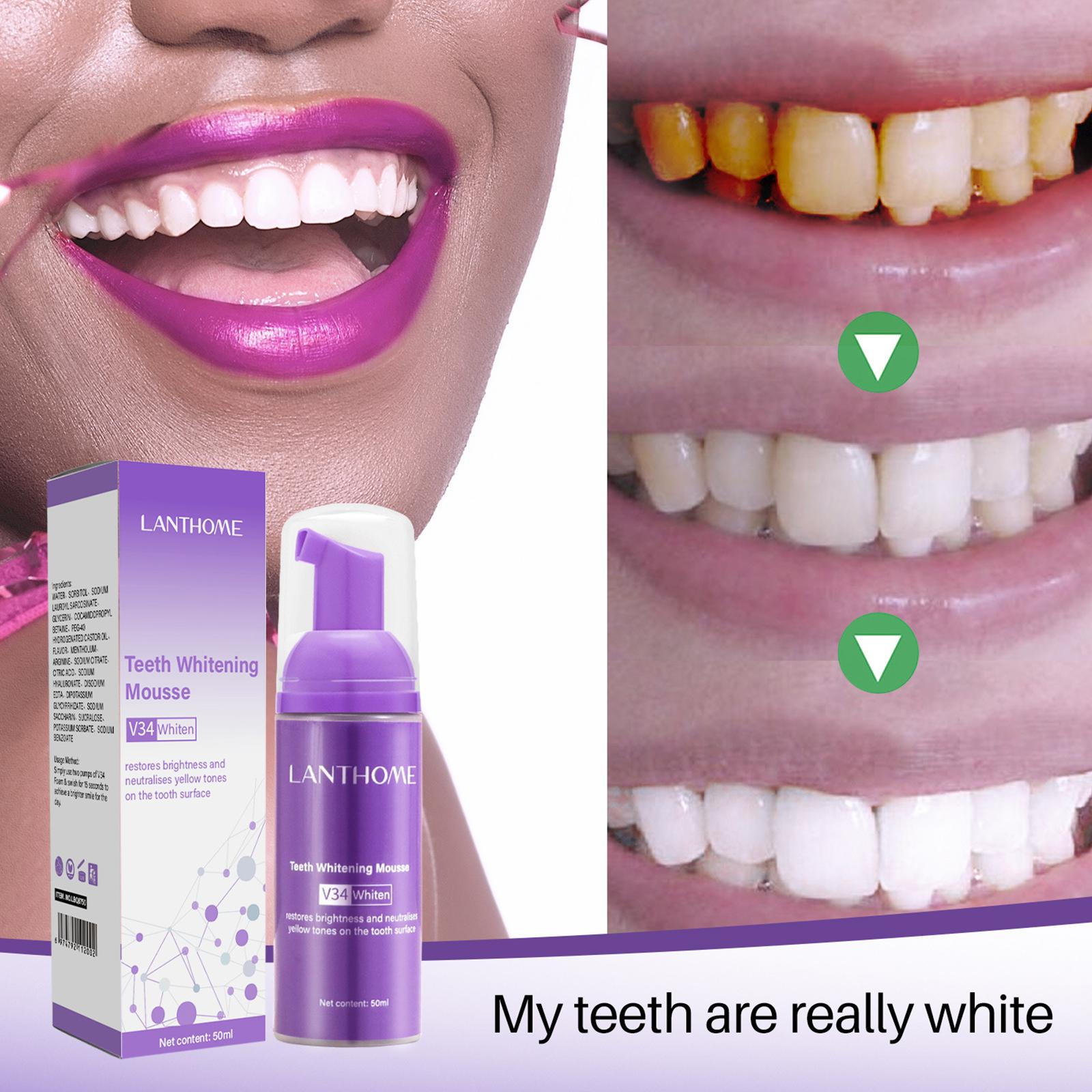 V34 Mousse Teeth Cleaning Toot - Teeth Whitening Effective review and price