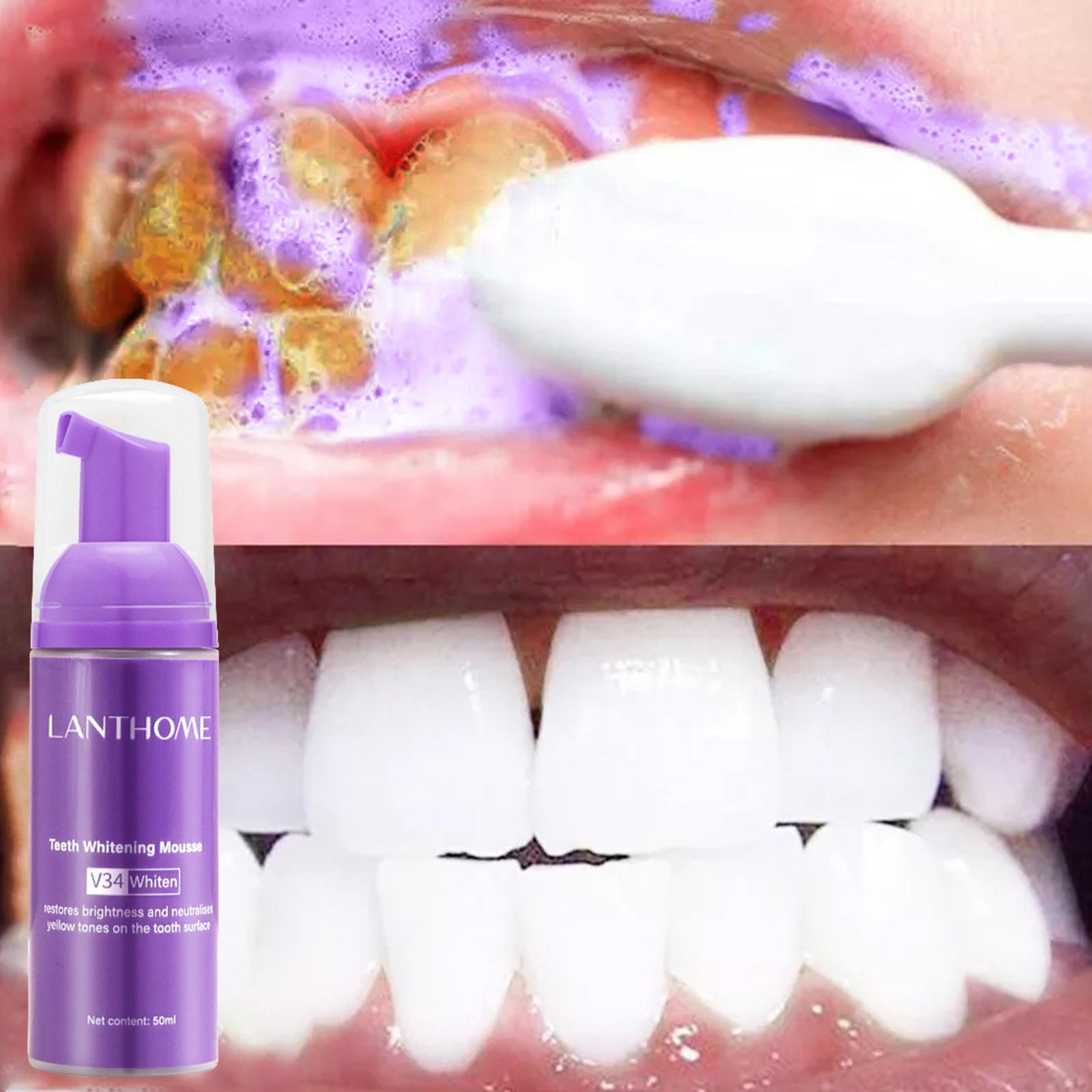 V34 Mousse Teeth Cleaning Toot - Teeth Whitening Effective review and price