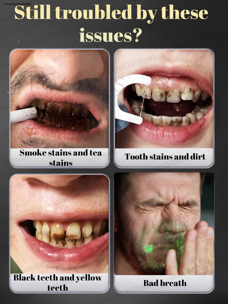 POZOAMIS 30% Hydroxyapatite To - Teeth Whitening In Office review and price