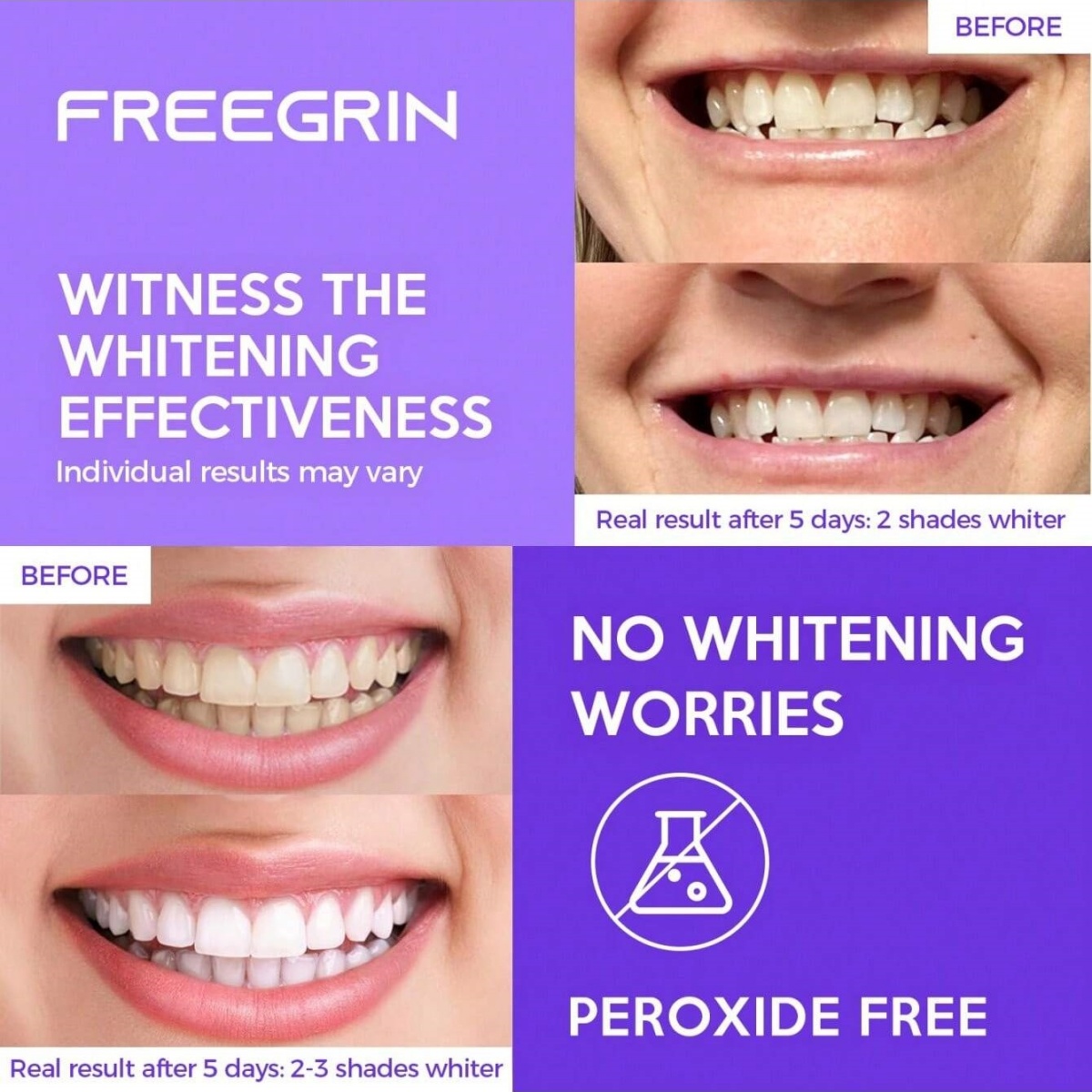 Deluxe Whitening Teeth Sticker - Teeth Whitening In Office review and price