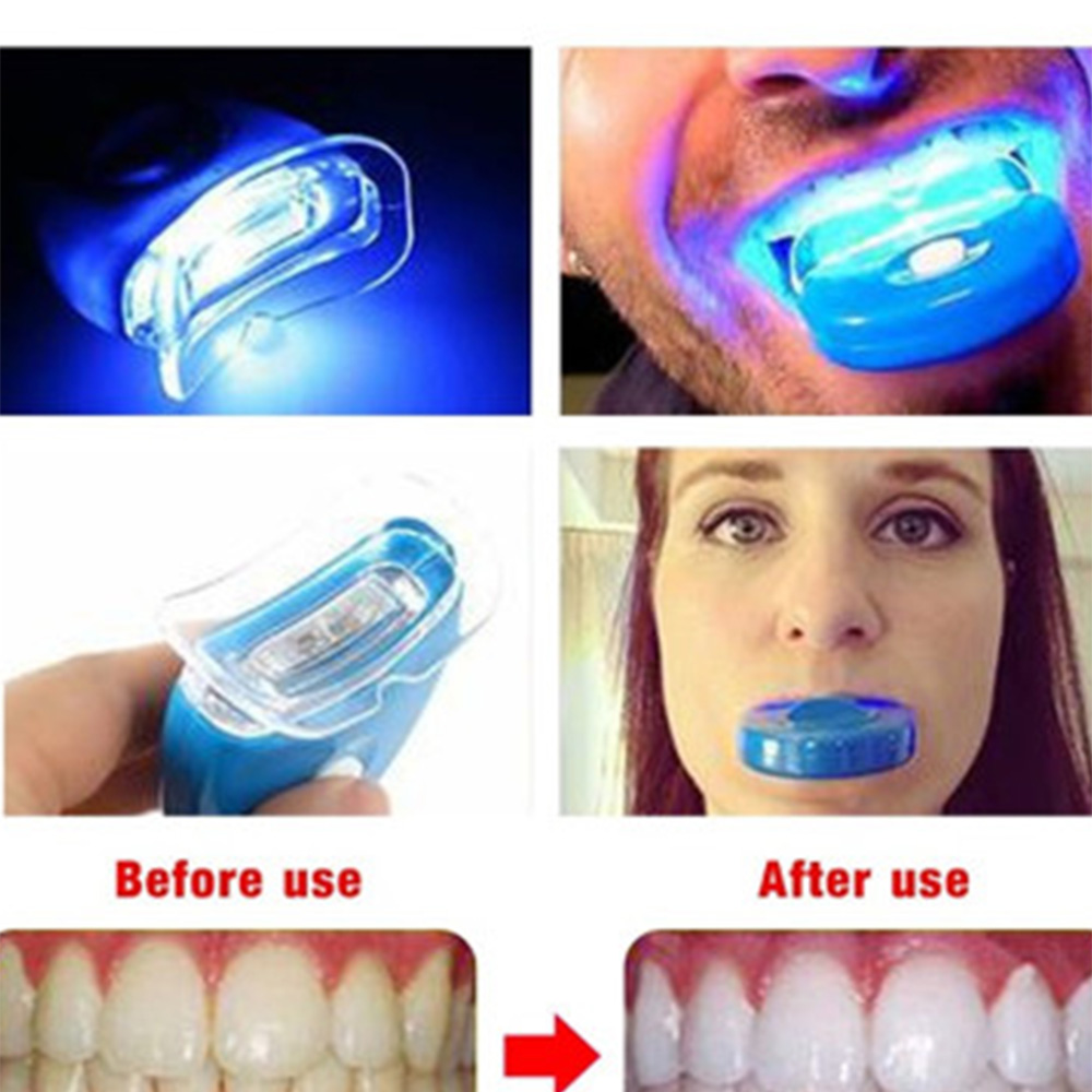 New Blue Led Teeth Whitening A - Teeth Whitening In Office review and price