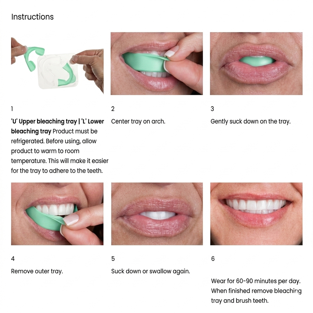 Opalescence GO 6% Hydrogen Per - Teeth Whitening In Office review and price