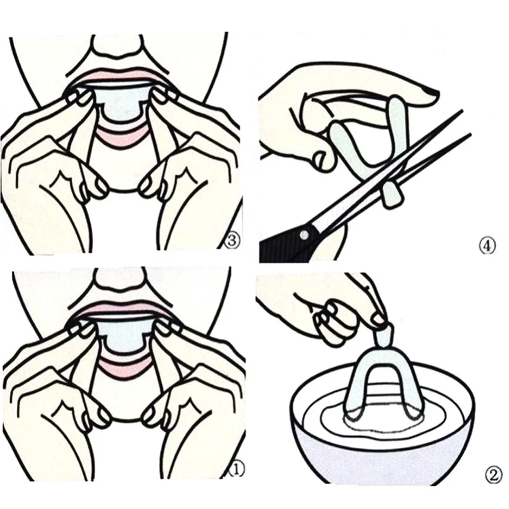 Silicone Braces Cold Light Whi - Teeth Whitening In Office review and price