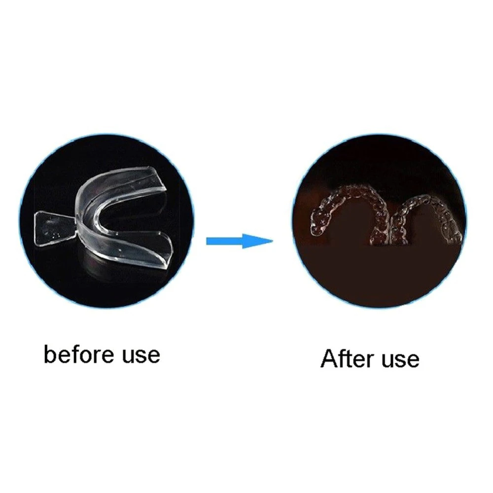 Silicone Braces Cold Light Whi - Teeth Whitening In Office review and price
